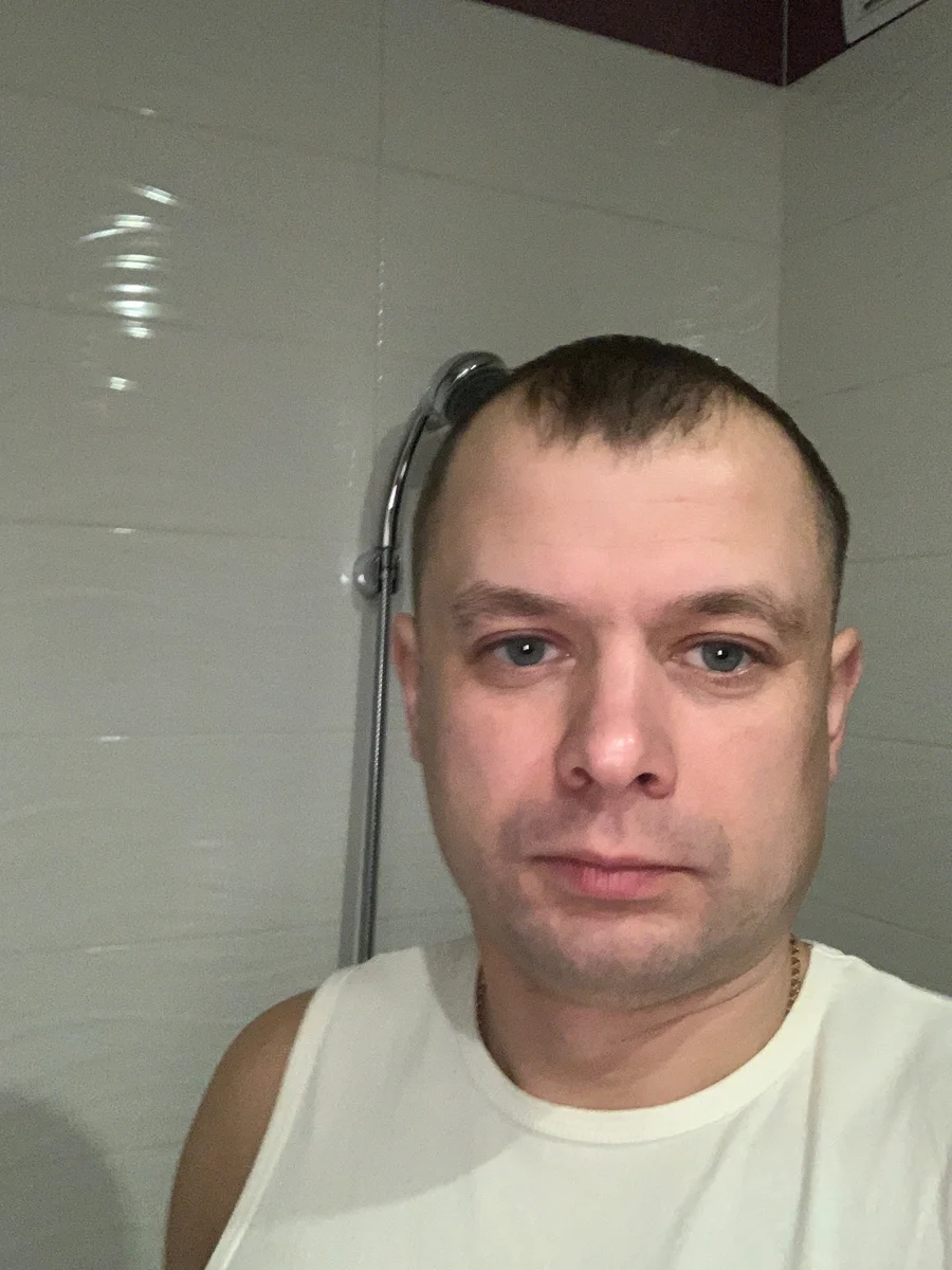 Vorher Foto 2